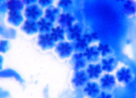 �N�h�A�E�Z�v�e���Ev�E��N�^�[�^�i�E�q�j