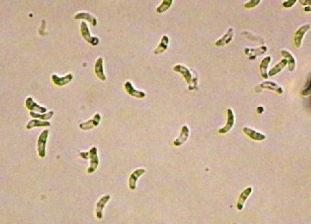 �U���R�V�X�e�B�X�E�t�F�A���[�i�u���f�B�]�C�g�j